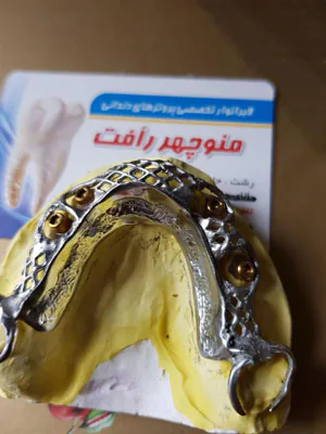 فریم کرومکبالت ساختهشده در رشت